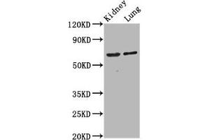 Western Blot Positive WB detected in: Rat kidney tissue, Mouse lung tissue All lanes: SRRM4 antibody at 4. (SRRM4 Antikörper  (AA 400-479))