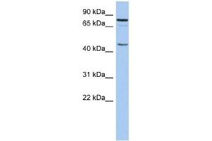 RNF169 antibody used at 1 ug/ml to detect target protein. (RNF169 Antikörper  (N-Term))