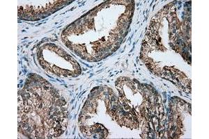 Immunohistochemical staining of paraffin-embedded pancreas tissue using anti-PIM2 mouse monoclonal antibody. (PIM2 Antikörper)