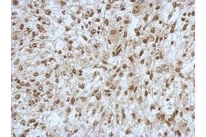 Image no. 2 for anti-Sin3A-Associated Protein, 130kDa (SAP130) (N-Term) antibody (ABIN1494118) (SAP130 Antikörper  (N-Term))