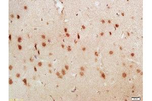 Formalin-fixed and paraffin embedded rat brain labeled with Anti-LUC7L3 Polyclonal Antibody, Unconjugated  at 1:200 followed by conjugation to the secondary antibody and DAB staining (LUC7-Like 3 Antikörper  (AA 31-130))