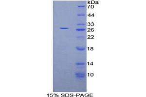 SDS-PAGE analysis of Human GSTm4 Protein. (GSTM4 Protein)