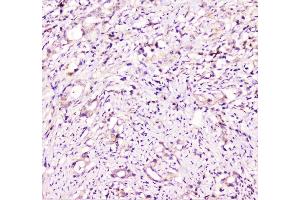 IHC analysis of TANK using anti-TANK antibody (ABIN6719508). (TANK Antikörper)