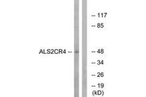 Western blot analysis of extracts from Jurkat cells, using ALS2CR4 Antibody.