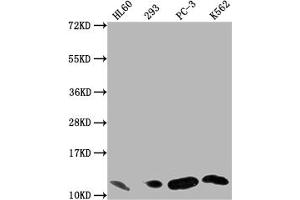 Western Blot Positive WB detected in: HL60 whole cell lysate, 293 whole cell lysate, PC-3 whole cell lysate, K562 whole cell lysate All lanes: MIF antibody at 1:1500 Secondary Goat polyclonal to rabbit IgG at 1/50000 dilution Predicted band size: 13 kDa Observed band size: 13 kDa (Rekombinanter MIF Antikörper)