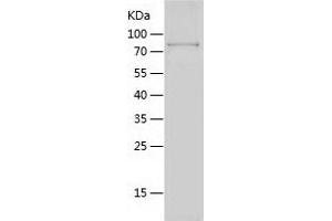 IKZF2 Protein (AA 2-526) (His-IF2DI Tag)