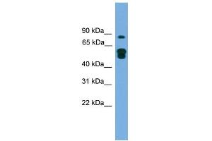 WB Suggested Anti-KIAA1609 Antibody Titration: 0. (KIAA1609 Antikörper  (N-Term))