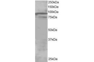 Image no. 1 for anti-Oxysterol Binding Protein-Like 11 (OSBPL11) (C-Term) antibody (ABIN374377) (OSBPL11 Antikörper  (C-Term))