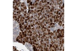 Immunohistochemical staining of human pancreas with FBF1 polyclonal antibody  shows strong cytoplasmic positivity in exocrine glandular cells.