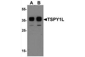 Western blot analysis of TSPY1L in A20 cell lysate with TSPY1L Antibody   at (A) 0. (TSPY1 Antikörper  (C-Term, Isoform 2))