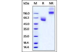 SDS-PAGE (SDS) image for CD47 (CD47) (AA 19-141) (Active) protein (Fc Tag) (ABIN4949054)