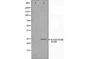Western blot analysis on HeLa cell lysate using RASH/RASK/RASN Antibody,The lane on the left is treated with the antigen-specific peptide. (RASH/RASK/RASN Antikörper)
