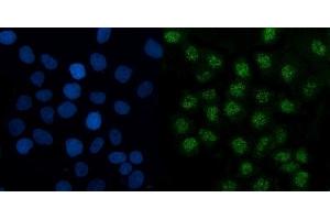 IF analysis of TMED5/p28 using anti-TMED5/p28 antibody (ABIN7601339).