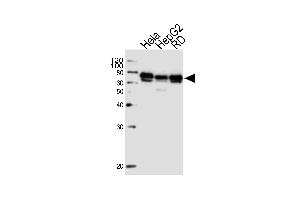 Western blot analysis of lysates from Hela, HepG2, RD cell line (from left to right), using PRKAG3 Antibody (C-term) (ABIN1537314 and ABIN2848560). (PRKAG3 Antikörper  (C-Term))
