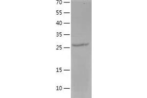 Western Blotting (WB) image for Membrane-Spanning 4-Domains, Subfamily A, Member 1 (MS4A1) (AA 141-188) protein (His-IF2DI Tag) (ABIN7123909)