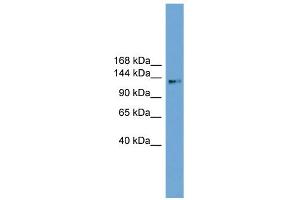 WB Suggested Anti-CCDC146 Antibody Titration: 0. (CCDC146 Antikörper  (Middle Region))