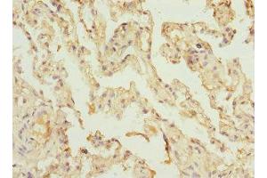 Immunohistochemistry of paraffin-embedded human lung tissue using ABIN7175319 at dilution of 1:100 (VPS4A Antikörper  (AA 1-120))