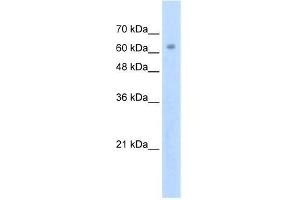 Human Jurkat; WB Suggested Anti-ZNF274 Antibody Titration: 2.