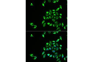 Immunofluorescence analysis of HeLa cells using CSNK1A1L antibody.