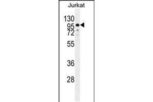Western blot analysis in Jurkat cell line lysates (35ug/lane). (ZNF841 Antikörper  (N-Term))