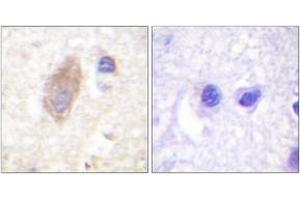 Immunohistochemistry (IHC) image for anti-Rabphilin 3A (RPH3A) (AA 203-252) antibody (ABIN2888698) (RPH3A Antikörper  (AA 203-252))