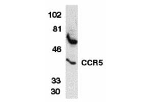Western Blotting (WB) image for anti-Chemokine (C-C Motif) Receptor 5 (CCR5) (N-Term) antibody (ABIN1031308) (CCR5 Antikörper  (N-Term))