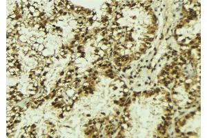 ABIN6278220 at 1/100 staining Human lung tissue by IHC-P.