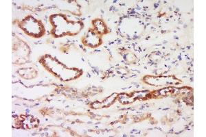 Formalin-fixed and paraffin embedded human kidney labeled with Anti-Protein kinase C beta, Isoform II Polyclonal Antibody, Unconjugated  at 1:200 followed by conjugation to the secondary antibody and DAB staining. (PKC beta Antikörper  (AA 601-673))