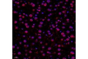 Immunofluorescence of paraffin embedded mouse liver using USP24 (ABIN7076111) at dilution of 1:650 (400x lens)