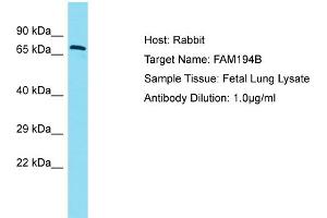 Host: Rabbit Target Name: FAM194B Sample Type: Fetal Lung lysates Antibody Dilution: 1. (FAM194B Antikörper  (C-Term))