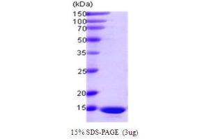 SDS-PAGE (SDS) image for Programmed Cell Death 5 (PDCD5) (AA 1-125) protein (ABIN667714)