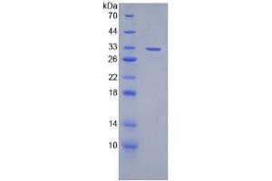 SDS-PAGE analysis of Mouse Lymphotoxin beta Protein. (LTB Protein)