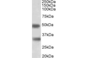 Western Blotting (WB) image for anti-GTP Binding Protein Overexpressed in Skeletal Muscle (GEM) (Internal Region) antibody (ABIN2465110) (GEM Antikörper  (Internal Region))