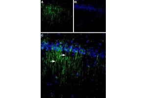 Expression of CaSR in rat brain - Immunohistochemical staining of rat hippocampal CA1 region using Anti-Calcium Sensing Receptor (extracellular) Antibody (ABIN7043018, ABIN7044161 and ABIN7044162). (CASR Antikörper  (Extracellular, N-Term))