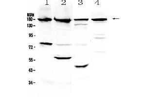 Western blot analysis of ErbB 4 using anti-ErbB 4 antibody . (ERBB4 Antikörper)