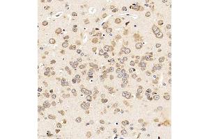 Immunohistochemistry of paraffin embedded mouse brain using LEG8 (ABIN7074474) at dilution of 1:1000 (300x lens) (LGALS8 Antikörper)