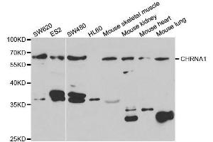 Western blot analysis of extracts of various cell lines, using CHRNA1 antibody. (CHRNA1 Antikörper  (AA 105-220))