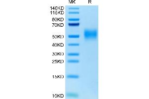 CD47 Protein (CD47) (AA 19-141) (His tag)