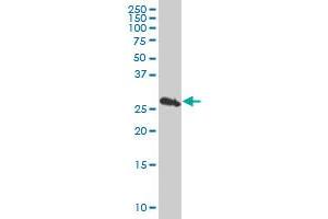 PSMB10 monoclonal antibody (M01), clone 3F8 Western Blot analysis of PSMB10 expression in Jurkat . (PSMB10 Antikörper  (AA 1-273))