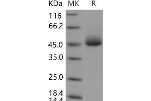 ACPP Protein (His tag)