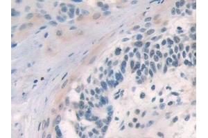 Immunohistochemistry (IHC) image for anti-Suppressor of Cytokine Signaling 2 (SOCS2) (AA 1-198) antibody (ABIN7443314)