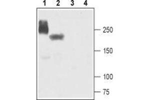 Western blot analysis of human-NaV1. (SCN5A Antikörper  (Intracellular))
