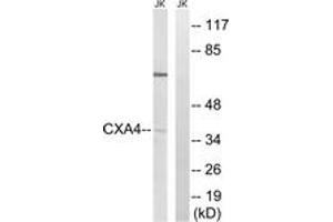 Western blot analysis of extracts from Jurkat cells, using GJA4 Antibody. (GJA4 Antikörper  (AA 81-130))