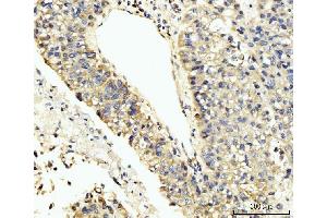 IHC analysis of LARP4B using anti-LARP4B antibody (ABIN7600865).