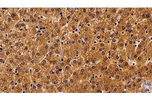 Detection of ALCAM in Human Liver Tissue using Monoclonal Antibody to Activated Leukocyte Cell Adhesion Molecule (ALCAM) (CD166 Antikörper  (AA 28-527))