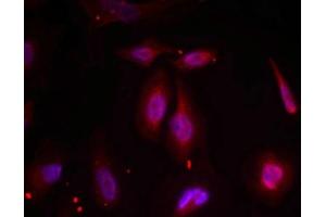 Immunofluorescence staining of methanol-fixed Hela cells using ATF2(Phospho-Thr69 or 51) Antibody. (ATF2 Antikörper  (pThr69))