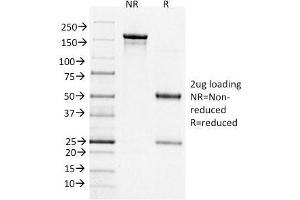 SDS-PAGE Analysis Purified BCL-6 Mouse Monoclonal Antibody (BCL6/1526). (BCL6 Antikörper  (AA 256-389))