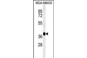 Western blot analysis in MDA-MB435 cell line lysates (35ug/lane). (FBXL14 Antikörper  (C-Term))