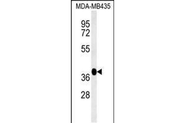 FBXL14 antibody  (C-Term)
