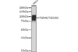 Western blot analysis of extracts of HeLa cells, using TGN46/TGOLN2 Rabbit mAb (ABIN7270875) at 1:1000 dilution. (TGOLN2 Antikörper)
